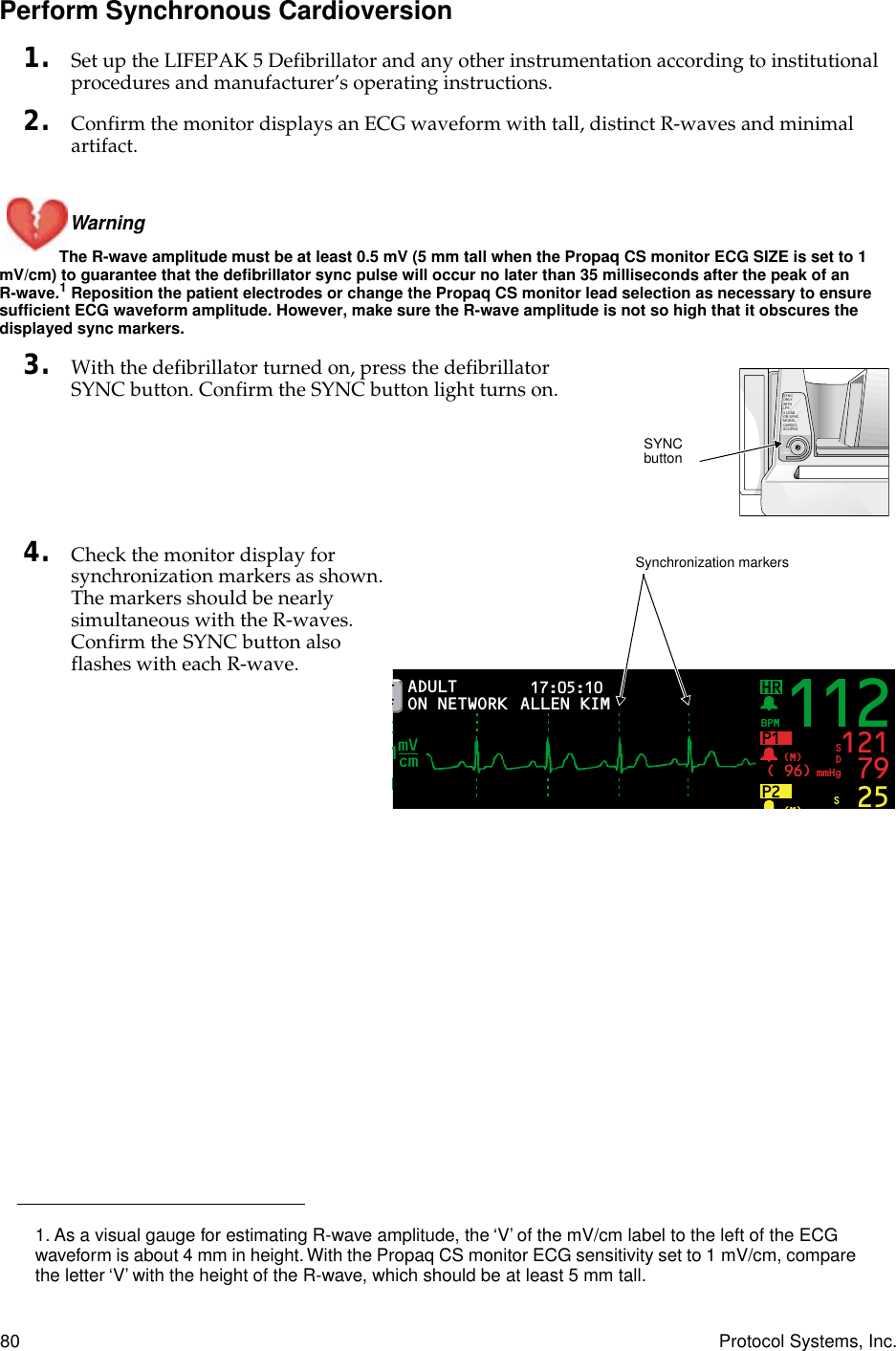 80 Protocol Systems, Inc.Perform Synchronous Cardioversion1. Set up the LIFEPAK 5 Defibrillator and any other instrumentation according to institutional procedures and manufacturer’s operating instructions.2. Confirm the monitor displays an ECG waveform with tall, distinct R-waves and minimal artifact. Warning The R-wave amplitude must be at least 0.5 mV (5 mm tall when the Propaq CS monitor ECG SIZE is set to 1 mV/cm) to guarantee that the defibrillator sync pulse will occur no later than 35 milliseconds after the peak of an R-wave.1 Reposition the patient electrodes or change the Propaq CS monitor lead selection as necessary to ensure sufficient ECG waveform amplitude. However, make sure the R-wave amplitude is not so high that it obscures the displayed sync markers.3. With the defibrillator turned on, press the defibrillator SYNC button. Confirm the SYNC button light turns on.4. Check the monitor display for synchronization markers as shown. The markers should be nearly simultaneous with the R-waves. Confirm the SYNC button also flashes with each R-wave.1. As a visual gauge for estimating R-wave amplitude, the ‘V’ of the mV/cm label to the left of the ECG waveform is about 4 mm in height. With the Propaq CS monitor ECG sensitivity set to 1 mV/cm, compare the letter ‘V’ with the height of the R-wave, which should be at least 5 mm tall.SYNCONLYWITHLP53 LEADOR SYNCMODELCARDIO-SCOPESSYNC(PUSH)SYNC buttonT FHRN17:05:10 PRINT FAULTIP1( 96)BPMmmHg(M) 121 79SDP2(M)25SADULTON NETWORKmVcm1112ALLEN KIMSynchronization markers