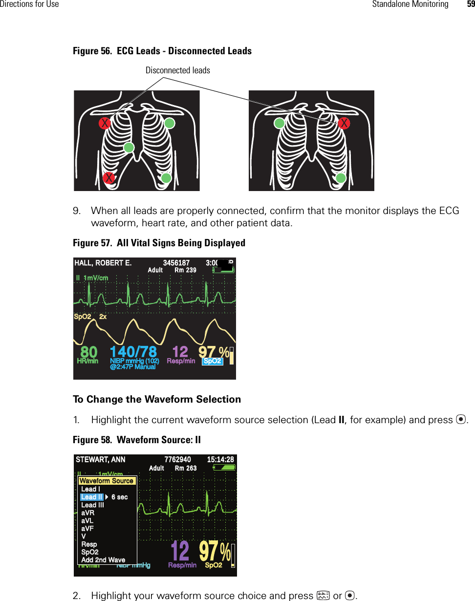 Directions for Use Standalone Monitoring 59Figure 56.  ECG Leads - Disconnected Leads9. When all leads are properly connected, confirm that the monitor displays the ECG waveform, heart rate, and other patient data.Figure 57.  All Vital Signs Being DisplayedTo Change the Waveform Selection1. Highlight the current waveform source selection (Lead II, for example) and press  . Figure 58.  Waveform Source: II2. Highlight your waveform source choice and press  or .XXXDisconnected leads140/78140/78808012129797 %HALL, ROBERT E.HALL, ROBERT E.345618734561873:00:06P3:00:06PAdultAdultRm 239Rm 239HR/minHR/minNIBP mmHg (102)NIBP mmHg (102)@2:47P Manual@2:47P ManualResp/minResp/minSpO2SpO2SpO2SpO22x2xII  1mV/cmII  1mV/cm% % STEWART, ANN STEWART, ANN 7762940 7762940 15:14:28 15:14:28 Adult Adult Rm 263Rm 263HR/min HR/min NIBP mmHg NIBP mmHg Resp/min Resp/min SpO2 SpO2 II         1mV/cm II         1mV/cm  80  80  12  12  97  97 Waveform Source Waveform Source Lead I Lead I Lead II     6 sec Lead II     6 sec Lead III Lead III aVR aVR aVL aVL aVF aVF V V Resp Resp SpO2 SpO2 Add 2nd Wave Add 2nd Wave 