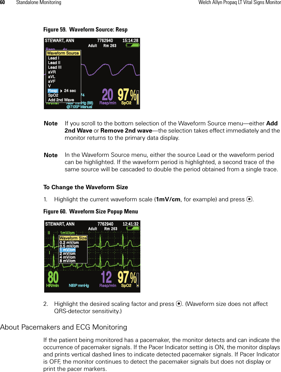 60 Standalone Monitoring Welch Allyn Propaq LT Vital Signs MonitorFigure 59.  Waveform Source: RespTo Change the Waveform Size1. Highlight the current waveform scale (1mV/cm, for example) and press .Figure 60.  Waveform Size Popup Menu2. Highlight the desired scaling factor and press . (Waveform size does not affect QRS-detector sensitivity.)About Pacemakers and ECG MonitoringIf the patient being monitored has a pacemaker, the monitor detects and can indicate the occurrence of pacemaker signals. If the Pacer Indicator setting is ON, the monitor displays and prints vertical dashed lines to indicate detected pacemaker signals. If Pacer Indicator is OFF, the monitor continues to detect the pacemaker signals but does not display or print the pacer markers.Note If you scroll to the bottom selection of the Waveform Source menu—either Add 2nd Wave or Remove 2nd wave—the selection takes effect immediately and the monitor returns to the primary data display. Note In the Waveform Source menu, either the source Lead or the waveform period can be highlighted. If the waveform period is highlighted, a second trace of the same source will be cascaded to double the period obtained from a single trace.% % STEWART, ANN STEWART, ANN 7762940 7762940 15:14:28 15:14:28 Adult Adult Rm 263Rm 263HR/min HR/min Resp/min Resp/min SpO2 SpO2 Resp       4x Resp       4x  60  60  20  20  97  97 130/74 130/74 NIBP mmHg (88) NIBP mmHg (88) @7:05P Manual @7:05P Manual Waveform Source Waveform Source Lead I Lead I Lead II Lead II Lead III Lead III aVR aVR aVL aVL aVF aVF V V Resp      24 sec Resp      24 sec SpO2 SpO2 Add 2nd Wave Add 2nd Wave % % HR/min HR/min NIBP mmHg NIBP mmHg Resp/min Resp/min SpO2 SpO2 II         1mV/cm II         1mV/cm  I         4mV/cm  I         4mV/cm STEWART, ANN STEWART, ANN 7762940 7762940 12:41:32 12:41:32 Adult Adult Rm 263Rm 263 80  80  12 12 97  97 Waveform Size Waveform Size 0.2 mV/cm 0.2 mV/cm 0.5 mV/cm 0.5 mV/cm 1 mV/cm 1 mV/cm 2 mV/cm 2 mV/cm 4 mV/cm 4 mV/cm 8 mV/cm 8 mV/cm 