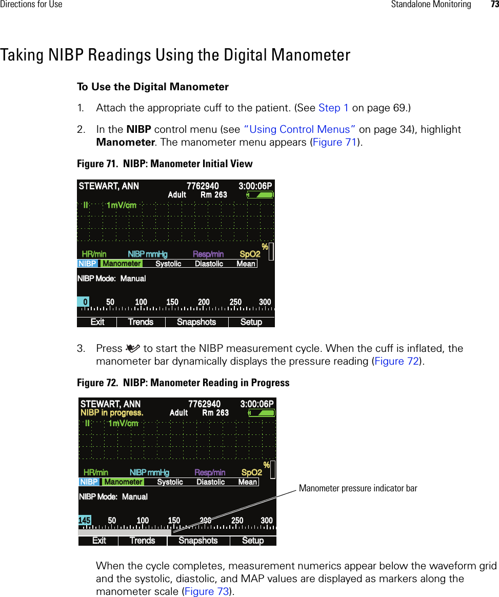 Directions for Use Standalone Monitoring 73Taking NIBP Readings Using the Digital ManometerTo Use the Digital Manometer1. Attach the appropriate cuff to the patient. (See Step 1 on page 69.)2. In the NIBP control menu (see “Using Control Menus” on page 34), highlight Manometer. The manometer menu appears (Figure 71). Figure 71.  NIBP: Manometer Initial View3. Press  to start the NIBP measurement cycle. When the cuff is inflated, the manometer bar dynamically displays the pressure reading (Figure 72).Figure 72.  NIBP: Manometer Reading in ProgressWhen the cycle completes, measurement numerics appear below the waveform grid and the systolic, diastolic, and MAP values are displayed as markers along the manometer scale (Figure 73).NIBP Mode: NIBP Mode: II        1mV/cm II        1mV/cm Exit Exit Trends Trends Snapshots Snapshots Setup Setup HR/min HR/min NIBP mmHg  NIBP mmHg  Resp/min Resp/min SpO2 SpO2 NIBP    NIBP    Systolic Systolic Diastolic Diastolic Mean Mean % % STEWART, ANN STEWART, ANN 7762940 7762940 3:00:06P 3:00:06P Adult Adult Rm 263Rm 263Manometer Manometer Manual Manual 0 0 50 50 100 100 150 150 200 200 250 250 300 300 NIBP Mode: NIBP Mode: II        1mV/cm II        1mV/cm Exit Exit Trends Trends Snapshots Snapshots Setup Setup HR/min HR/min NIBP mmHg  NIBP mmHg  Resp/min Resp/min SpO2 SpO2 NIBP    NIBP    Systolic Systolic Diastolic Diastolic Mean Mean % % STEWART, ANN STEWART, ANN 7762940 7762940 3:00:06P 3:00:06P Adult Adult Rm 263Rm 263Manometer Manometer Manual Manual NIBP in progress. NIBP in progress. 145 145 50 50 100 100 150 150 200 200 250 250 300 300 Manometer pressure indicator bar