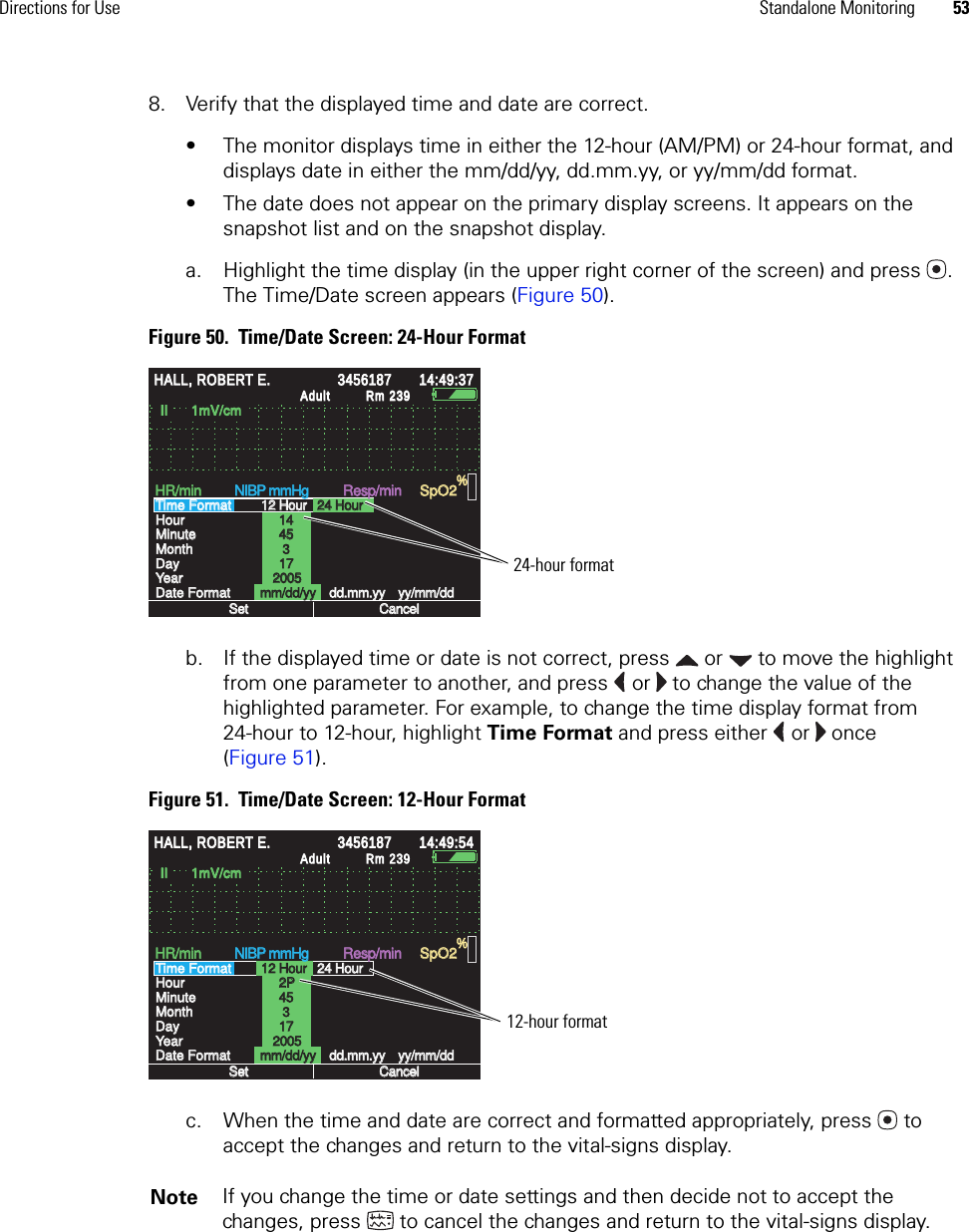 Directions for Use Standalone Monitoring 538. Verify that the displayed time and date are correct.• The monitor displays time in either the 12-hour (AM/PM) or 24-hour format, and displays date in either the mm/dd/yy, dd.mm.yy, or yy/mm/dd format.• The date does not appear on the primary display screens. It appears on the snapshot list and on the snapshot display.a. Highlight the time display (in the upper right corner of the screen) and press . The Time/Date screen appears (Figure 50).Figure 50.  Time/Date Screen: 24-Hour Formatb. If the displayed time or date is not correct, press   or   to move the highlight from one parameter to another, and press   or   to change the value of the highlighted parameter. For example, to change the time display format from 24-hour to 12-hour, highlight Time Format and press either   or   once (Figure 51).Figure 51.  Time/Date Screen: 12-Hour Formatc. When the time and date are correct and formatted appropriately, press   to accept the changes and return to the vital-signs display.Note If you change the time or date settings and then decide not to accept the changes, press   to cancel the changes and return to the vital-signs display.II      1mV/cmII      1mV/cmYearYearDate FormatDate FormatHR/minHR/minNIBP mmHgNIBP mmHgResp/minResp/minSpO2SpO2%14:49:3714:49:37AdultAdultTime FormatTime FormatHourHourMinuteMinuteMonthMonthDayDayHALL, ROBERT E.HALL, ROBERT E.34561873456187Rm 239Rm 23912 Hour12 Hour24 Hour24 Hour141445453171720052005mm/dd/yymm/dd/yydd.mm.yydd.mm.yyyy/mm/ddyy/mm/ddSetSetCancelCancel24-hour formatII      1mV/cmII      1mV/cmYearYearDate FormatDate FormatHR/minHR/minNIBP mmHgNIBP mmHgResp/minResp/minSpO2SpO2%14:49:5414:49:54AdultAdultTime FormatTime FormatHourHourMinuteMinuteMonthMonthDayDayHALL, ROBERT E.HALL, ROBERT E.34561873456187Rm 239Rm 23912 Hour12 Hour24 Hour24 Hour2P2P45453171720052005mm/dd/yymm/dd/yydd.mm.yydd.mm.yyyy/mm/ddyy/mm/ddSetSetCancelCancel12-hour format