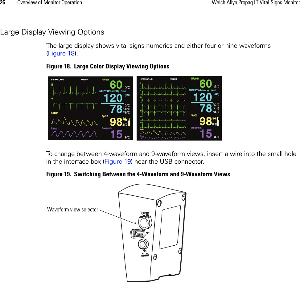 26 Overview of Monitor Operation Welch Allyn Propaq LT Vital Signs MonitorLarge Display Viewing OptionsThe large display shows vital signs numerics and either four or nine waveforms (Figure 18).Figure 18.  Large Color Display Viewing OptionsTo change between 4-waveform and 9-waveform views, insert a wire into the small hole in the interface box (Figure 19) near the USB connector.Figure 19.  Switching Between the 4-Waveform and 9-Waveform Views 15  15 % %  60  60  78  78  98  98  120  120 S S D D M M 220 220 75 75 110  110 35 35 120 120 50 50 Manual Manual 120 120 50 50 100 100 90 90 120 120 50 50 (89) (89) STEWART, ANN STEWART, ANN HR/min HR/min NIBP/PSNI-mmHgNIBP/PSNI-mmHgResp/min Resp/min SpO2 SpO2 II II SpO2 SpO2 Resp Resp 7762940 7762940 V V I I Resp Resp V V II II III III aVR aVR aVL aVL aVF aVF SpO2 SpO2  15  15 % %  60  60  78  78  98  98  120  120 S S D D M M 220 220 75 75 110  110 35 35 120 120 50 50 Manual Manual 120 120 50 50 100 100 90 90 120 120 50 50 (89) (89) HR/min HR/min NIBP/PSNI-mmHgNIBP/PSNI-mmHgResp/min Resp/min SpO2 SpO2 STEWART, ANN STEWART, ANN 7762940 7762940 Waveform view selector