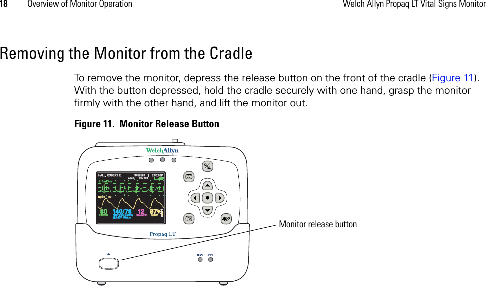 18 Overview of Monitor Operation Welch Allyn Propaq LT Vital Signs MonitorRemoving the Monitor from the CradleTo remove the monitor, depress the release button on the front of the cradle (Figure 11). With the button depressed, hold the cradle securely with one hand, grasp the monitor firmly with the other hand, and lift the monitor out. Figure 11.  Monitor Release Button14040/7878808012129797%HALL, ROBERT E.HALL, ROBERT E.345618734561873:00:06P3:00:06PAdult,Adult,Rm 239Rm  23 9HR/minHR/minNIBP mmHg (102)NIBP mmHg (102)@2:47P Manual@2:47P ManualResp/minResp/minSpO2SpO2SpO2SpO22x2xII  1mV/cmII  1mV/cmMonitor release button