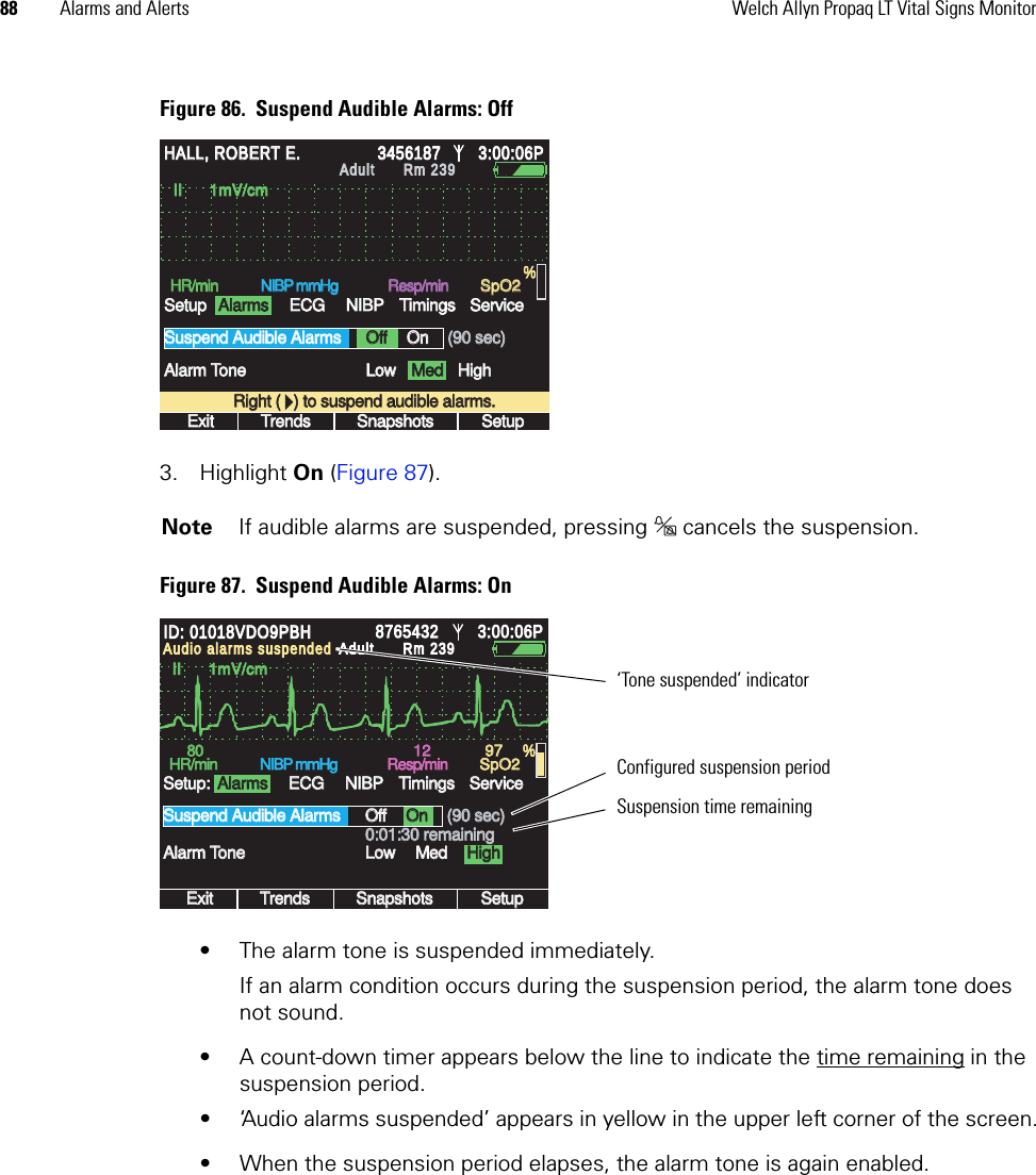 88 Alarms and Alerts Welch Allyn Propaq LT Vital Signs MonitorFigure 86.  Suspend Audible Alarms: Off3. Highlight On (Figure 87).Figure 87.  Suspend Audible Alarms: On• The alarm tone is suspended immediately. If an alarm condition occurs during the suspension period, the alarm tone does not sound.• A count-down timer appears below the line to indicate the time remaining in the suspension period.• ‘Audio alarms suspended’ appears in yellow in the upper left corner of the screen.• When the suspension period elapses, the alarm tone is again enabled.Note If audible alarms are suspended, pressing   cancels the suspension.II      1mV/cmII      1mV/cmExitExitTrendsTrendsSnapshotsSnapshotsSetupSetupLowLowMedMedHR/minHR/minNIBP mmHgNIBP mmHgResp/minResp/minSpO2SpO2OffOffOnOnAlarm ToneAlarm ToneSuspend Audible AlarmsSuspend Audible AlarmsSetupSetup(90 sec)(90 sec)%3:00:06P3:00:06PAdultAdultRm 239Rm 239AlarmsAlarmsECGECGNIBPNIBPTimingsTimingsHighHighServiceServiceHALL, ROBERT E.HALL, ROBERT E.34561873456187Right (   ) to suspend audible alarms.Right (   ) to suspend audible alarms.II      1mV/cmII      1mV/cmExitExitTrendsTrendsSnapshotsSnapshotsSetupSetupLowLowMedMed8080HR/minHR/minNIBP mmHgNIBP mmHgResp/minResp/minSpO2SpO2OffOffOnOnAlarm ToneAlarm ToneSuspend Audible AlarmsSuspend Audible AlarmsSetup:Setup:(90 sec)(90 sec)12129797%876543287654323:00:06P3:00:06PAdultAdultRm 239Rm 239AlarmsAlarmsECGECGNIBPNIBPTimingsTimingsHighHighServiceService0:01:30 remaining0:01:30 remainingAudio alarms suspendedAudio alarms suspendedID: 01018VDO9PBHID: 01018VDO9PBH‘Tone suspended’ indicatorSuspension time remainingConfigured suspension period