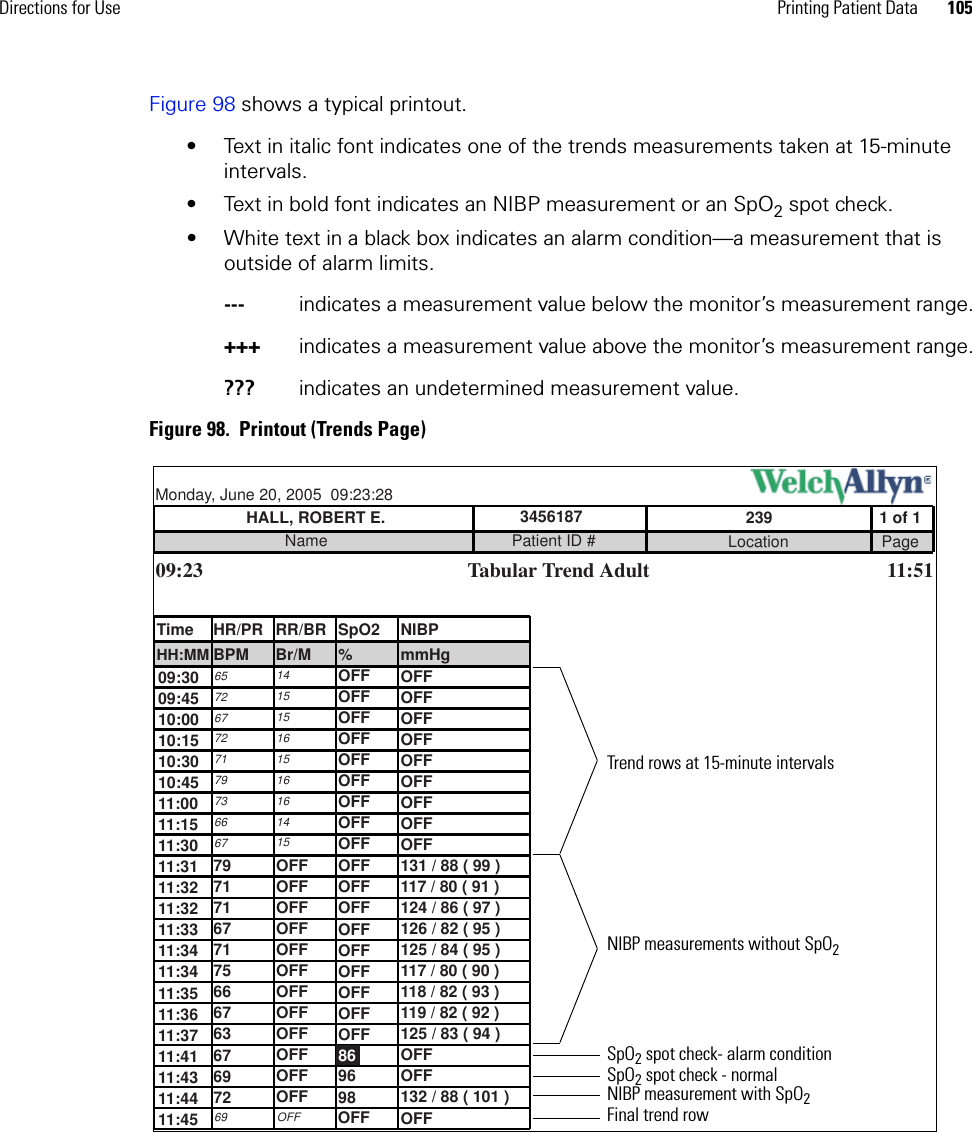 Directions for Use Printing Patient Data 105Figure 98 shows a typical printout.• Text in italic font indicates one of the trends measurements taken at 15-minute intervals.• Text in bold font indicates an NIBP measurement or an SpO2 spot check.• White text in a black box indicates an alarm condition—a measurement that is outside of alarm limits.---  indicates a measurement value below the monitor’s measurement range.+++  indicates a measurement value above the monitor’s measurement range.???  indicates an undetermined measurement value.Figure 98.  Printout (Trends Page)86Monday, June 20, 2005  09:23:28HALL, ROBERT E.Name3456187Patient ID #Tabular Trend Adult1 of 1239Location Page09:23 11:51Time HR/PR RR/BR SpO2 NIBPHH:MM BPM Br/M % mmHg09:3009:4510:0010:1510:3011:3111:3211:3311:3210:4511:1511:3011:3411:3611:0011:3411:3511:3711:4311:4411:4111:4579717167717566676367697265726772717973666769141515161516161415OFFOFFOFFOFFOFFOFFOFFOFFOFFOFFOFFOFFOFFOFFOFFOFFOFFOFFOFFOFFOFFOFFOFFOFFOFF9896OFFOFFOFFOFFOFFOFFOFF131 / 88 ( 99 )OFFOFFOFF117 / 80 ( 91 )124 / 86 ( 97 )126 / 82 ( 95 )125 / 84 ( 95 )117 / 80 ( 90 )118 / 82 ( 93 )119 / 82 ( 92 )125 / 83 ( 94 )132 / 88 ( 101 )OFFOFFOFFOFFOFFOFFOFFOFFOFFTrend rows at 15-minute intervalsFinal trend rowNIBP measurements without SpO2SpO2 spot check- alarm conditionSpO2 spot check - normalNIBP measurement with SpO2