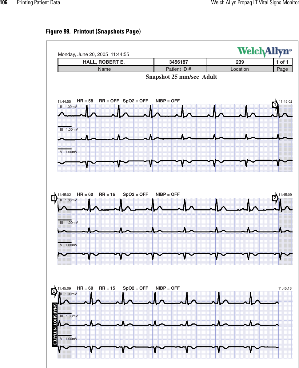 106 Printing Patient Data Welch Allyn Propaq LT Vital Signs MonitorFigure 99.  Printout (Snapshots Page)SNAPSHOT INITIATED11 of 1NameMonday, June 20, 2005  11:44:55HALL, ROBERT E. 3456187Patient ID #239Location PageSnapshot 25 mm/sec  Adult11:44:55 HR = 58 RR = OFF SpO2 = OFF NIBP = OFF 11:45:02II   1.00mVIII   1.00mVV   1.00mV11:45:02 HR = 60 RR = 16 SpO2 = OFF NIBP = OFF 11:45:092II   1.00mVIII   1.00mVV   1.00mV1211:45:09 HR = 60 RR = 15 SpO2 = OFF NIBP = OFFII   1.00mVIII   1.00mVV   1.00mV11:45:16