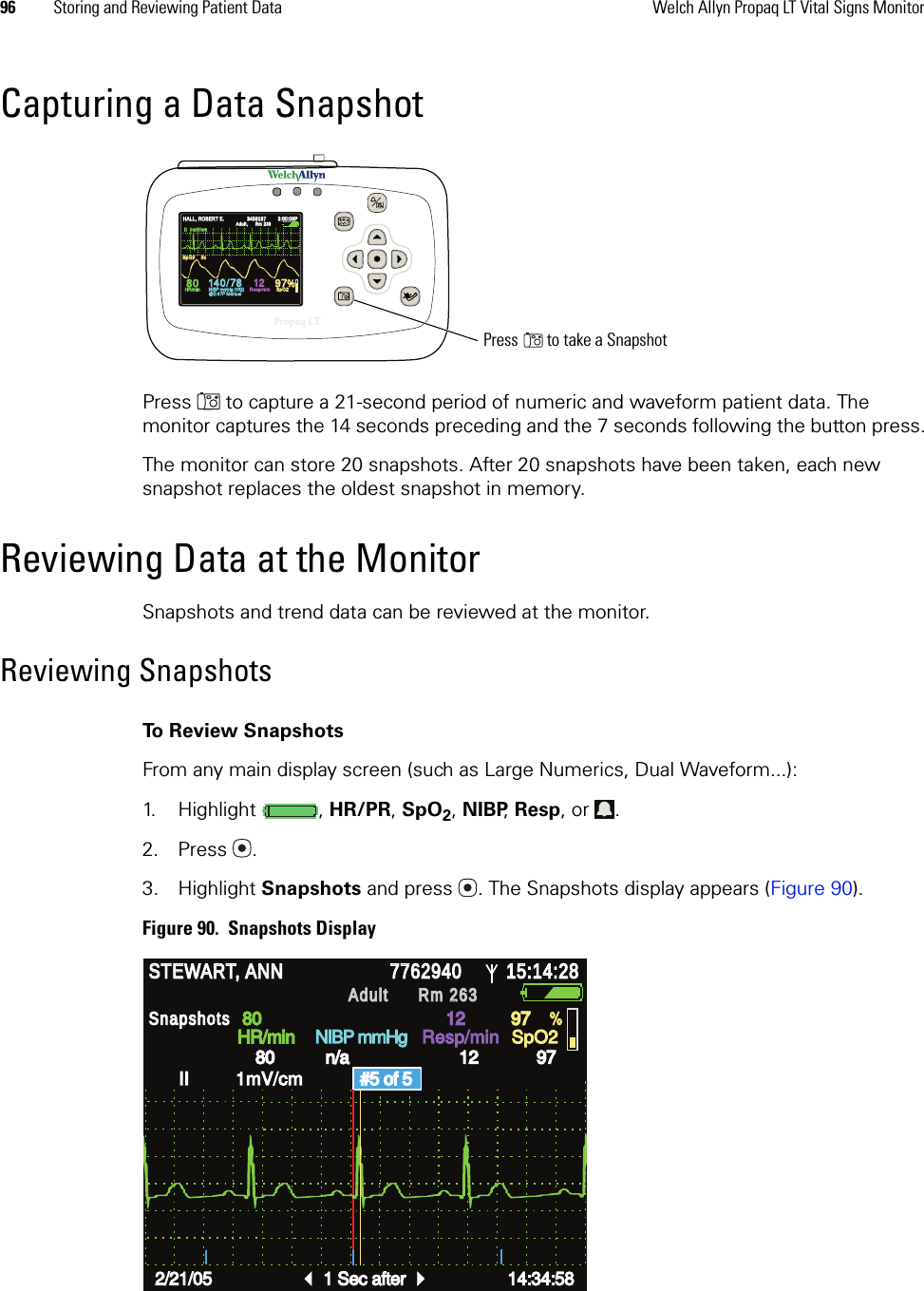 96 Storing and Reviewing Patient Data Welch Allyn Propaq LT Vital Signs MonitorCapturing a Data SnapshotPress  to capture a 21-second period of numeric and waveform patient data. The monitor captures the 14 seconds preceding and the 7 seconds following the button press.The monitor can store 20 snapshots. After 20 snapshots have been taken, each new snapshot replaces the oldest snapshot in memory.Reviewing Data at the MonitorSnapshots and trend data can be reviewed at the monitor.Reviewing SnapshotsTo Review SnapshotsFrom any main display screen (such as Large Numerics, Dual Waveform...):1. Highlight , HR/PR, SpO2, NIBP, Resp, or  .2. Press .3. Highlight Snapshots and press . The Snapshots display appears (Figure 90).Figure 90.  Snapshots Display14040/7878808012129797%HALL, ROBERT E.HALL, ROBERT E.345618734561873:00:06P3:00:06PAdult,Adult,Rm 239Rm  23 9HR/minHR/minNIBP mmHg (102)NIBP mmHg (102)@2:47P Manual@2:47P ManualResp/minResp/minSpO2SpO2SpO2SpO22x2xII  1mV/cmII  1mV/cmPropaq LTPress  to take a SnapshotSTEWART, ANN STEWART, ANN 7762940 7762940 15:14:28 15:14:28 Adult Adult Rm 263Rm 263HR/min HR/min NIBP mmHg NIBP mmHg Resp/min Resp/min SpO2 SpO2 II         1mV/cm II         1mV/cm Snapshots Snapshots 2/21/05 2/21/05 1 Sec after 1 Sec after 14:34:58 14:34:58 80 80 12 12 97 97 80 80 n/a n/a 12 12 97 97 % % #5 of 5 #5 of 5 