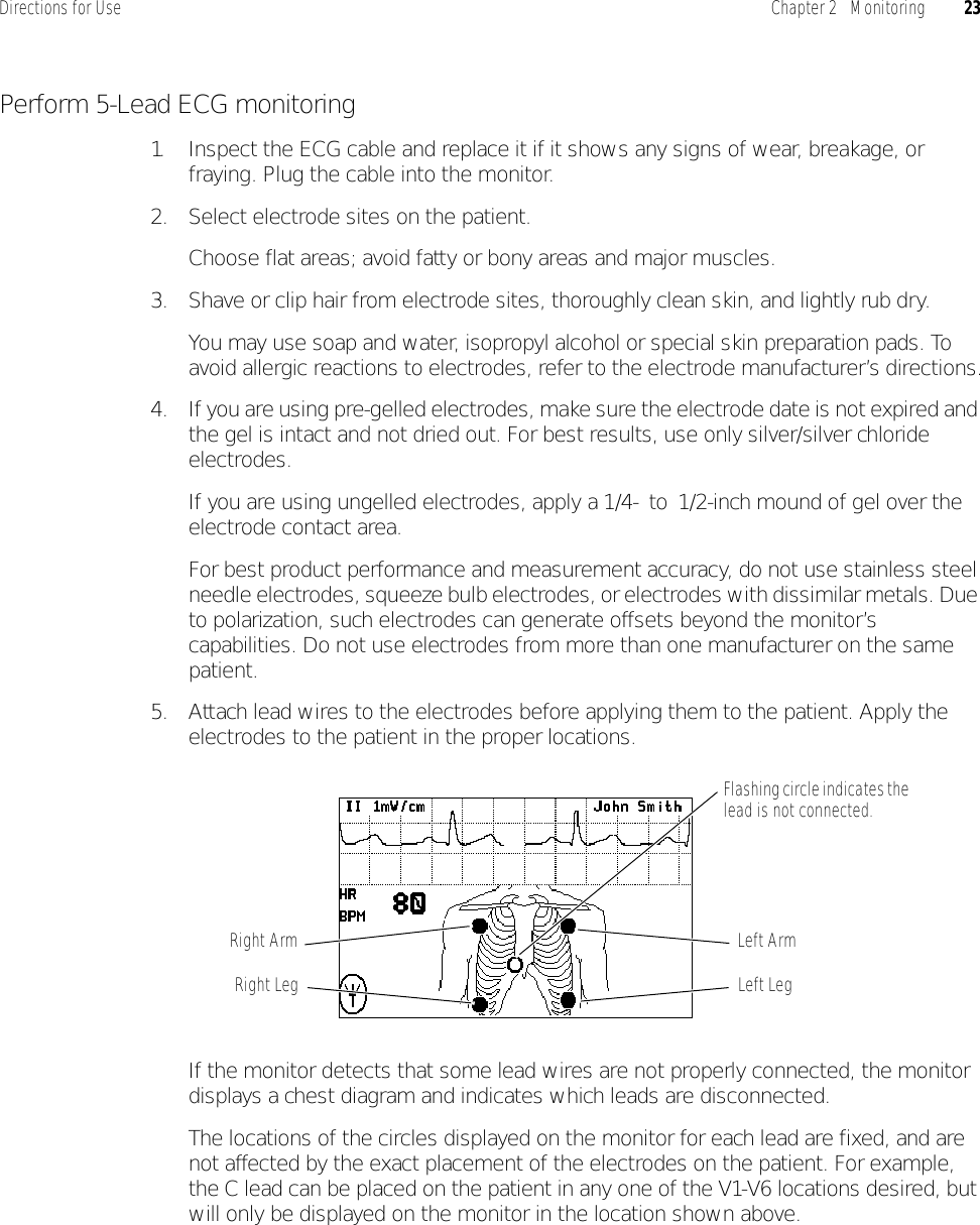 Directions for Use Chapter 2   Monitoring 23Perform 5-Lead ECG monitoring1. Inspect the ECG cable and replace it if it shows any signs of wear, breakage, or fraying. Plug the cable into the monitor.2. Select electrode sites on the patient.Choose flat areas; avoid fatty or bony areas and major muscles.3. Shave or clip hair from electrode sites, thoroughly clean skin, and lightly rub dry.You may use soap and water, isopropyl alcohol or special skin preparation pads. To avoid allergic reactions to electrodes, refer to the electrode manufacturer’s directions.4. If you are using pre-gelled electrodes, make sure the electrode date is not expired and the gel is intact and not dried out. For best results, use only silver/silver chloride electrodes.If you are using ungelled electrodes, apply a 1/4- to 1/2-inch mound of gel over the electrode contact area.For best product performance and measurement accuracy, do not use stainless steel needle electrodes, squeeze bulb electrodes, or electrodes with dissimilar metals. Due to polarization, such electrodes can generate offsets beyond the monitor’s capabilities. Do not use electrodes from more than one manufacturer on the same patient.5. Attach lead wires to the electrodes before applying them to the patient. Apply the electrodes to the patient in the proper locations.If the monitor detects that some lead wires are not properly connected, the monitor displays a chest diagram and indicates which leads are disconnected.The locations of the circles displayed on the monitor for each lead are fixed, and are not affected by the exact placement of the electrodes on the patient. For example, the C lead can be placed on the patient in any one of the V1-V6 locations desired, but will only be displayed on the monitor in the location shown above.Flashing circle indicates the lead is not connected.Left ArmRight ArmLeft LegRight Leg