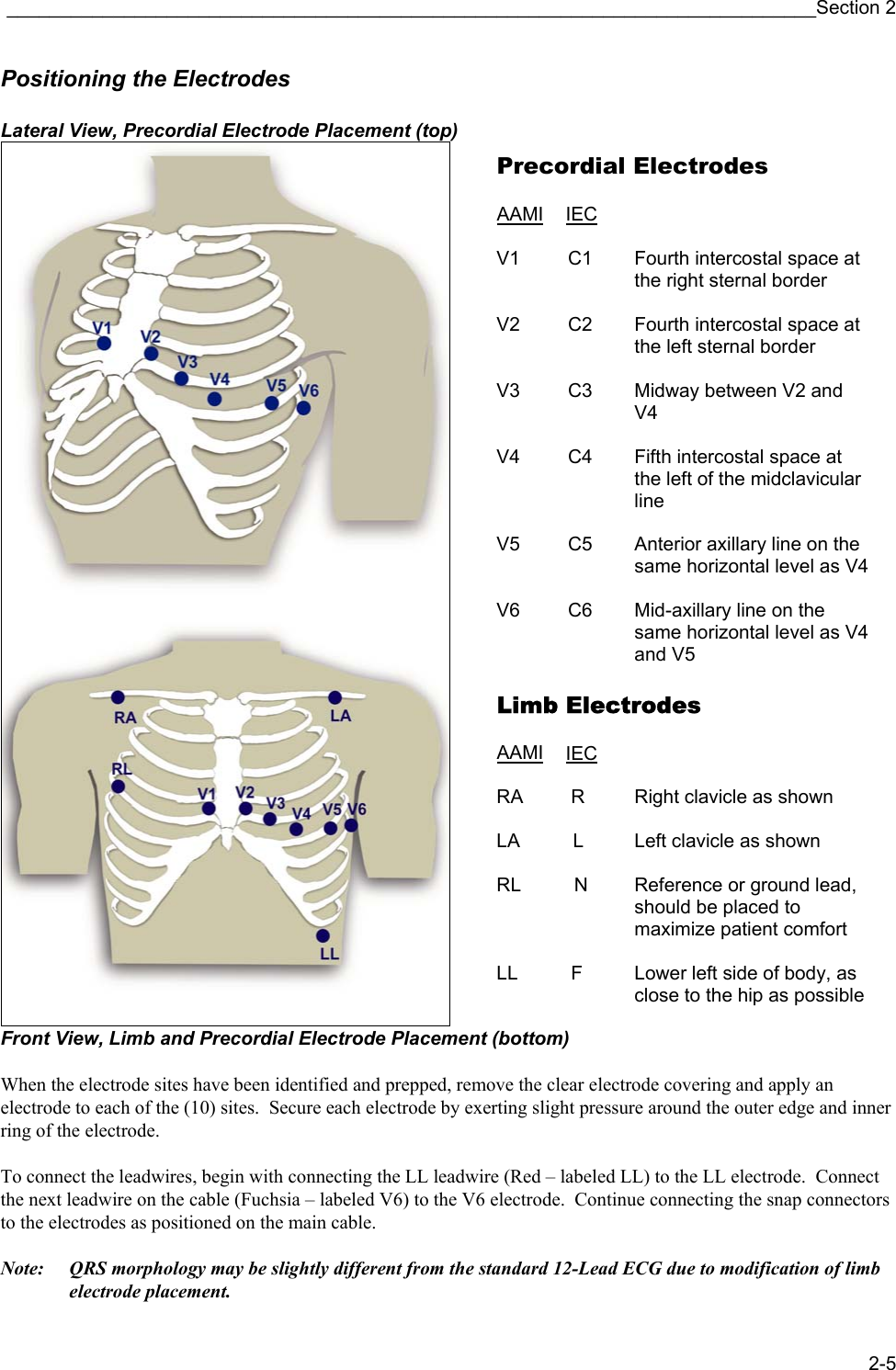 ____________________________________________________________________________Section 2 2-5 Positioning the Electrodes  Lateral View, Precordial Electrode Placement (top)  Front View, Limb and Precordial Electrode Placement (bottom)  When the electrode sites have been identified and prepped, remove the clear electrode covering and apply an electrode to each of the (10) sites.  Secure each electrode by exerting slight pressure around the outer edge and inner ring of the electrode.  To connect the leadwires, begin with connecting the LL leadwire (Red – labeled LL) to the LL electrode.  Connect the next leadwire on the cable (Fuchsia – labeled V6) to the V6 electrode.  Continue connecting the snap connectors to the electrodes as positioned on the main cable.  Note:  QRS morphology may be slightly different from the standard 12-Lead ECG due to modification of limb electrode placement. Precordial Electrodes  AAMI IEC  V1         C1  Fourth intercostal space at the right sternal border  V2         C2  Fourth intercostal space at the left sternal border  V3         C3    Midway between V2 and V4  V4         C4    Fifth intercostal space at  the left of the midclavicular line  V5         C5    Anterior axillary line on the same horizontal level as V4 V6         C6    Mid-axillary line on the  same horizontal level as V4and V5  Limb Electrodes  AAMI IEC  RA         R    Right clavicle as shown  LA          L    Left clavicle as shown  RL          N  Reference or ground lead, should be placed to maximize patient comfort  LL          F    Lower left side of body, as  close to the hip as possible 