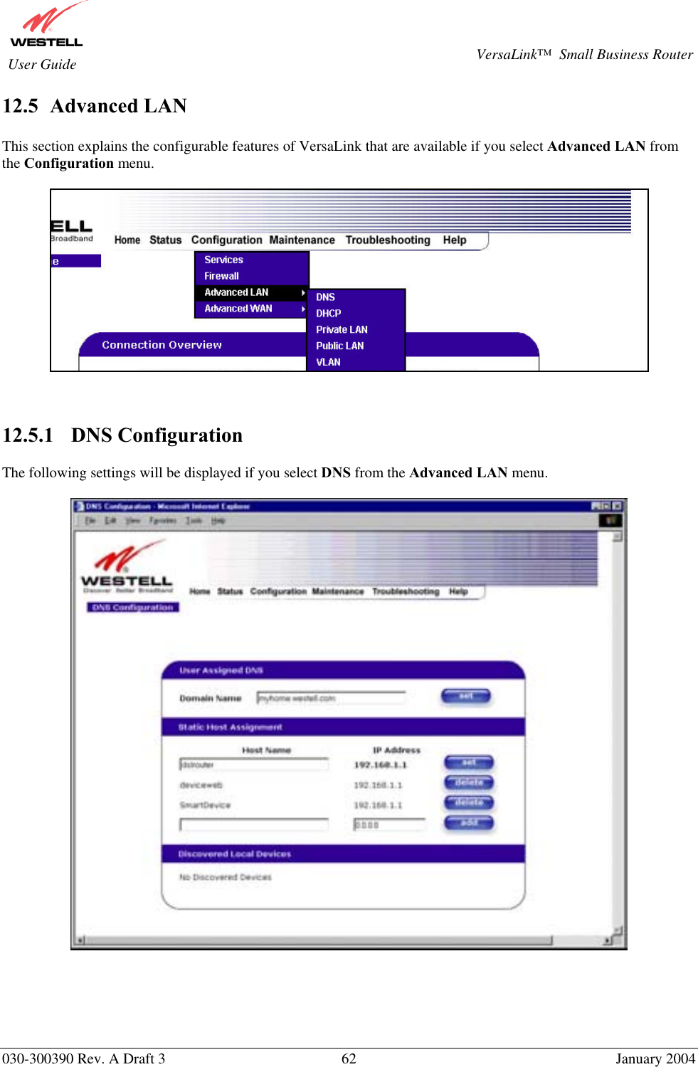       030-300390 Rev. A Draft 3  62  January 2004  VersaLink™  Small Business Router  User Guide 12.5  Advanced LAN  This section explains the configurable features of VersaLink that are available if you select Advanced LAN from the Configuration menu.      12.5.1    DNS Configuration  The following settings will be displayed if you select DNS from the Advanced LAN menu.        