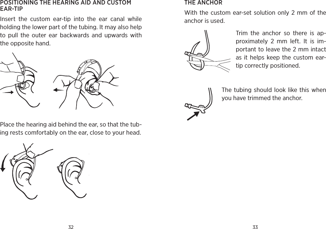 32 33POSITIONING THE HEARING AID AND CUSTOM EAR-TIPInsert  the  custom  ear-tip  into  the  ear  canal  while holding the lower part of the tubing. It may also help to  pull  the  outer  ear  backwards  and  upwards  with the opposite hand.Place the hearing aid behind the ear, so that the tub-ing rests comfortably on the ear, close to your head. THE ANCHORWith the  custom ear-set solution only 2 mm of the anchor is used.Trim  the  anchor  so  there  is  ap-proximately  2  mm  left.  It  is  im-portant to leave the 2 mm intact as  it  helps keep the  custom ear-tip correctly positioned.The tubing  should look  like this  when you have trimmed the anchor.