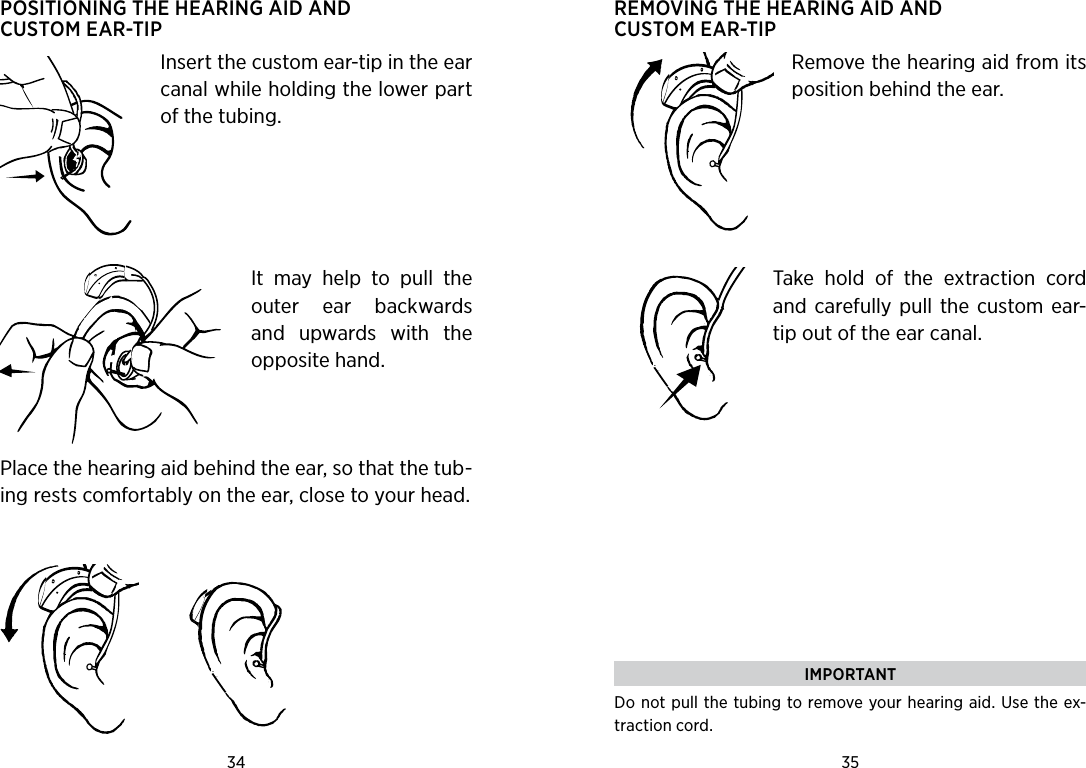 34 35 POSITIONING THE HEARING AID AND CUSTOM EAR-TIPInsert the custom ear-tip in the ear canal while holding the lower part of the tubing.  It  may  help  to  pull  the outer  ear  backwards and  upwards  with  the opposite hand.   Place the hearing aid behind the ear, so that the tub-ing rests comfortably on the ear, close to your head.REMOVING THE HEARING AID AND  CUSTOM EAR-TIPRemove the hearing aid from its position behind the ear.Take  hold  of  the  extraction  cord and  carefully  pull the custom ear-tip out of the ear canal.IMPORTANTDo not pull the tubing  to remove your hearing aid. Use the ex-traction cord.