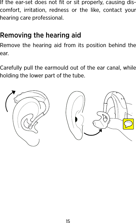 15If the ear-set does not fit or sit properly, causing dis-comfort, irritation, redness or the like, contact your hearing care professional.Removing the hearing aid Remove the hearing aid from its position behind the ear.Carefully pull the earmould out of the ear canal, while holding the lower part of the tube.
