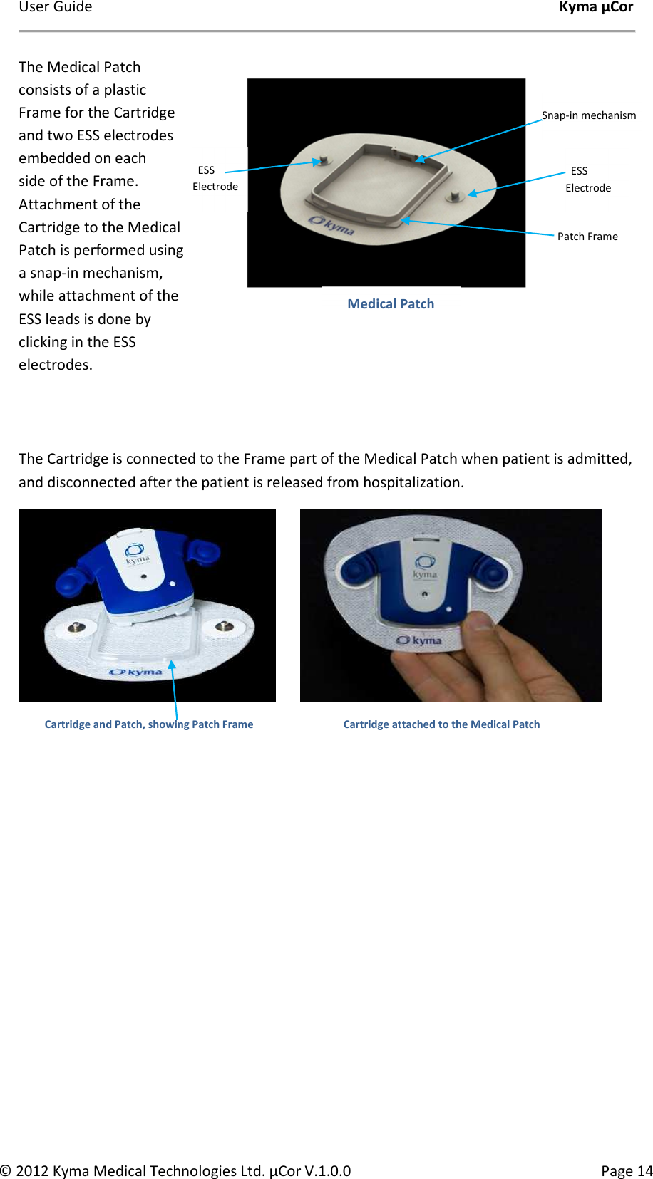 User Guide    Kyma µCor © 2012 Kyma Medical Technologies Ltd. µCor V.1.0.0  Page 14   ESS Electrode   ESS Electrode Patch Frame Snap-in mechanism Medical Patch The Medical Patch consists of a plastic Frame for the Cartridge and two ESS electrodes embedded on each side of the Frame. Attachment of the Cartridge to the Medical Patch is performed using a snap-in mechanism, while attachment of the ESS leads is done by clicking in the ESS electrodes.  The Cartridge is connected to the Frame part of the Medical Patch when patient is admitted, and disconnected after the patient is released from hospitalization.                                                Cartridge and Patch, showing Patch Frame  Cartridge attached to the Medical Patch 