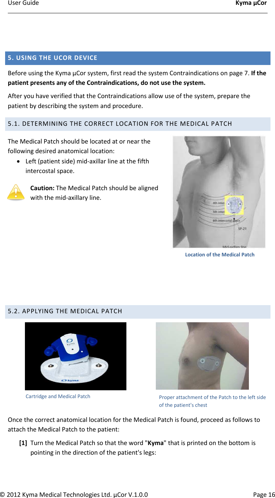 User Guide    Kyma µCor © 2012 Kyma Medical Technologies Ltd. µCor V.1.0.0  Page 16 Cartridge and Medical Patch     5. USING THE UCOR DEVICE Before using the Kyma µCor system, first read the system Contraindications on page 7. If the patient presents any of the Contraindications, do not use the system. After you have verified that the Contraindications allow use of the system, prepare the patient by describing the system and procedure.  5.1. DETERMINING THE CORRECT LOCATION FOR THE MEDICAL PATCH The Medical Patch should be located at or near the following desired anatomical location: • Left (patient side) mid-axillar line at the fifth intercostal space.  Caution: The Medical Patch should be aligned with the mid-axillary line.       5.2. APPLYING THE MEDICAL PATCH                                    Once the correct anatomical location for the Medical Patch is found, proceed as follows to attach the Medical Patch to the patient:  [1] Turn the Medical Patch so that the word &quot;Kyma&quot; that is printed on the bottom is pointing in the direction of the patient&apos;s legs: Proper attachment of the Patch to the left side of the patient&apos;s chest Location of the Medical Patch 