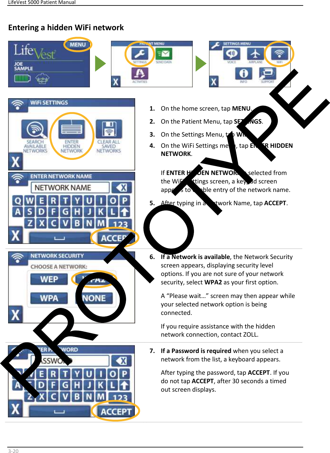     LifeVest 5000 Patient Manual        3 - 20   Entering a hidden WiFi network                1.   On the home screen, tap  MENU .   2.   On the Patient Menu, tap  SETTINGS .  3.   On the Settings Menu, tap  WiFi .  4.   On the WiFi Settings menu, tap  ENTER HIDDEN  NETWORK .    If  ENTER HIDDEN NETWORK  is selected from  the WiFi Settings screen, a keypad screen  appears to enable entry of the network name.   5.   After typing in a Network Name, tap  ACCEPT .        6.   If a  Network  is  available , the Network Security  screen appears, displaying security level  options. If you are not sure of your network  security, select  WPA2  as your first option.   A “Please wait…” screen may then appear while  your selected network option is being  connected.  If you require assistance with the hidden  network connection, contact ZOLL.      7.   If a  Password  is  required   wh en you select a  network from the list, a keyboard appears.   After typing the password, tap  ACCEPT . If you  do not tap  ACCEPT , after 30 seconds a timed  out screen displays.     