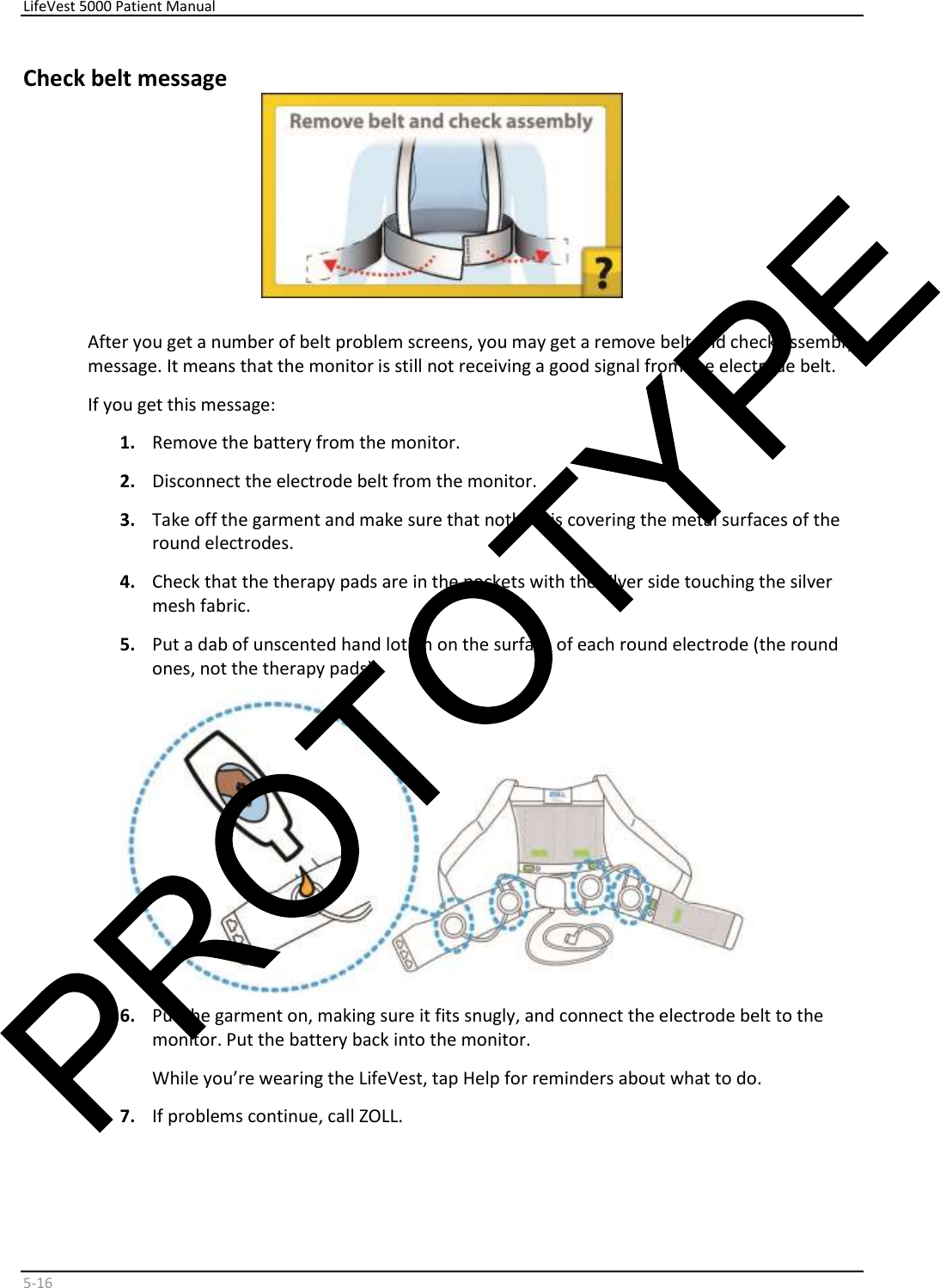     LifeVest 5000 Patient Manual        5 - 16   Check belt message    After you get a number of belt problem screens, you may get a remove belt and check assembly  message. It means that the monitor is still not receiving a good signal from the electrode belt.  If you get this message:  1.   Remove the battery from the monitor.  2.   Disconnect the electrode belt from the monitor.  3.   Take off the garment and make sure that nothing is covering the metal surfaces of the  round electrodes.   4.   Check that the therapy pads are in the pockets with the silver side touching the silver  mesh fabric.  5.   Put a dab of unscented hand lotion on the surface of each round electrode (the round  ones, not the therapy pads).    6.   Put the garment on, making sure it fits snugly, and connect the electrode belt to the  monitor. Put the battery back into the monitor.   While you’re wearing the LifeVest, tap Help for reminders about what to do.  7.   If problems continue, call ZOLL.     