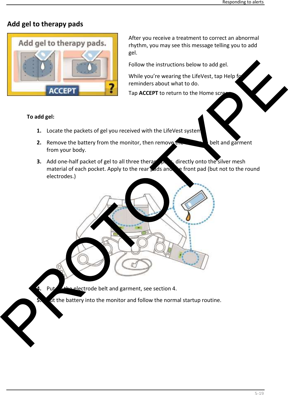     Responding to alerts    5 - 19   Add gel to therapy pads    After you receive a treatment to correct an abnormal  rhythm, you may see this message telling you to add  gel.   Follow the instructions below to add gel.  While you’re wearing the LifeVest, tap Help for  reminders about what to do.  Tap  ACCEPT   to return to the  Home   screen.     To add gel:   1.   Locate the packets of gel you received with the LifeVest system.  2.   Remove the battery from the monitor, then remove the electrode belt and garment  from your body.  3.   Add one-half packet of gel to all three therapy pads, directly onto the silver mesh  material of each pocket. Apply to the rear pads and the front pad (but not to the round  electrodes.)    4.   Put on the electrode belt and garment, see section 4.  5.   Put the battery into the monitor and follow the normal startup routine.          