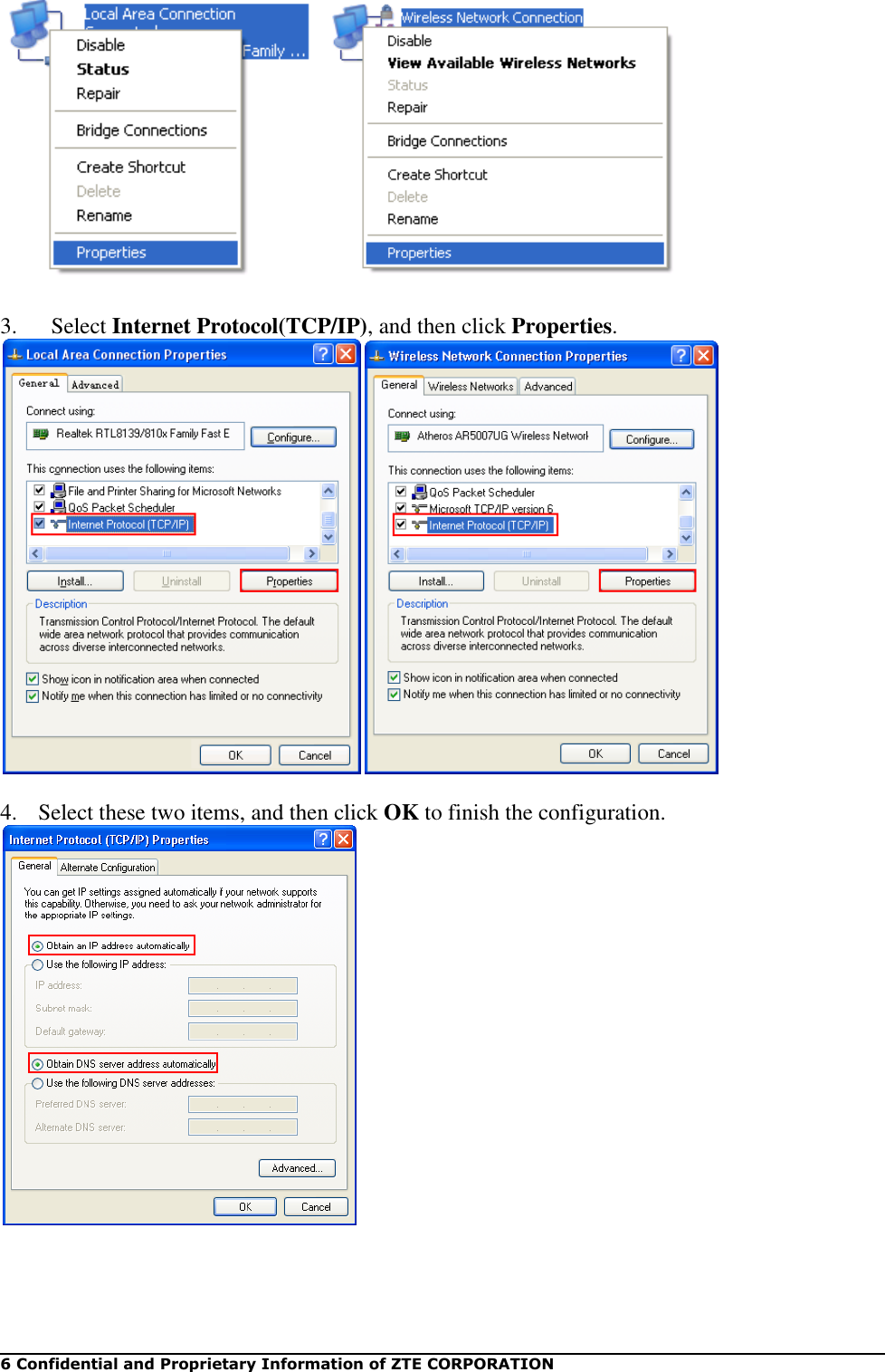   6 Confidential and Proprietary Information of ZTE CORPORATION   3.   Select Internet Protocol(TCP/IP), and then click Properties.   4.   Select these two items, and then click OK to finish the configuration.   
