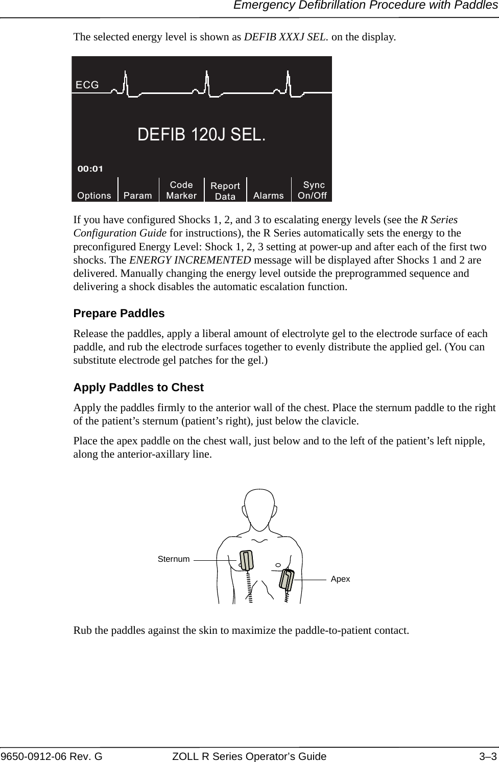 Emergency Defibrillation Procedure with Paddles9650-0912-06 Rev. G ZOLL R Series Operator’s Guide 3–3The selected energy level is shown as DEFIB XXXJ SEL. on the display.If you have configured Shocks 1, 2, and 3 to escalating energy levels (see the R Series Configuration Guide for instructions), the R Series automatically sets the energy to the preconfigured Energy Level: Shock 1, 2, 3 setting at power-up and after each of the first two shocks. The ENERGY INCREMENTED message will be displayed after Shocks 1 and 2 are delivered. Manually changing the energy level outside the preprogrammed sequence and delivering a shock disables the automatic escalation function.Prepare PaddlesRelease the paddles, apply a liberal amount of electrolyte gel to the electrode surface of each paddle, and rub the electrode surfaces together to evenly distribute the applied gel. (You can substitute electrode gel patches for the gel.)Apply Paddles to ChestApply the paddles firmly to the anterior wall of the chest. Place the sternum paddle to the right of the patient’s sternum (patient’s right), just below the clavicle.Place the apex paddle on the chest wall, just below and to the left of the patient’s left nipple, along the anterior-axillary line.Rub the paddles against the skin to maximize the paddle-to-patient contact.DEFIB 120J SEL.CodeMarkerOptions00:01ECG ParamReportData SyncOn/OffAlarmsSternumApex