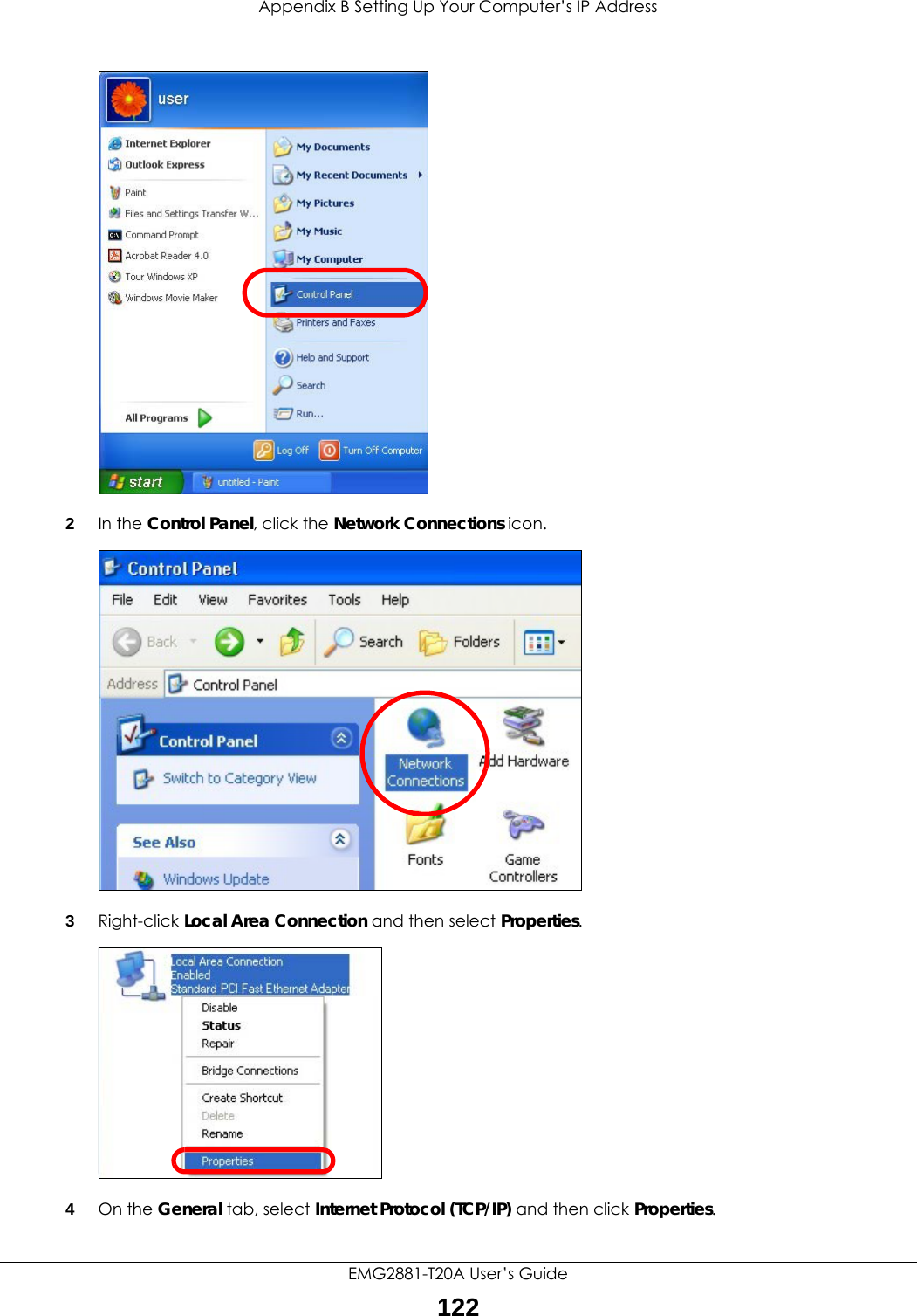 Appendix B Setting Up Your Computer’s IP AddressEMG2881-T20A User’s Guide1222In the Control Panel, click the Network Connections icon.3Right-click Local Area Connection and then select Properties.4On the General tab, select Internet Protocol (TCP/IP) and then click Properties.