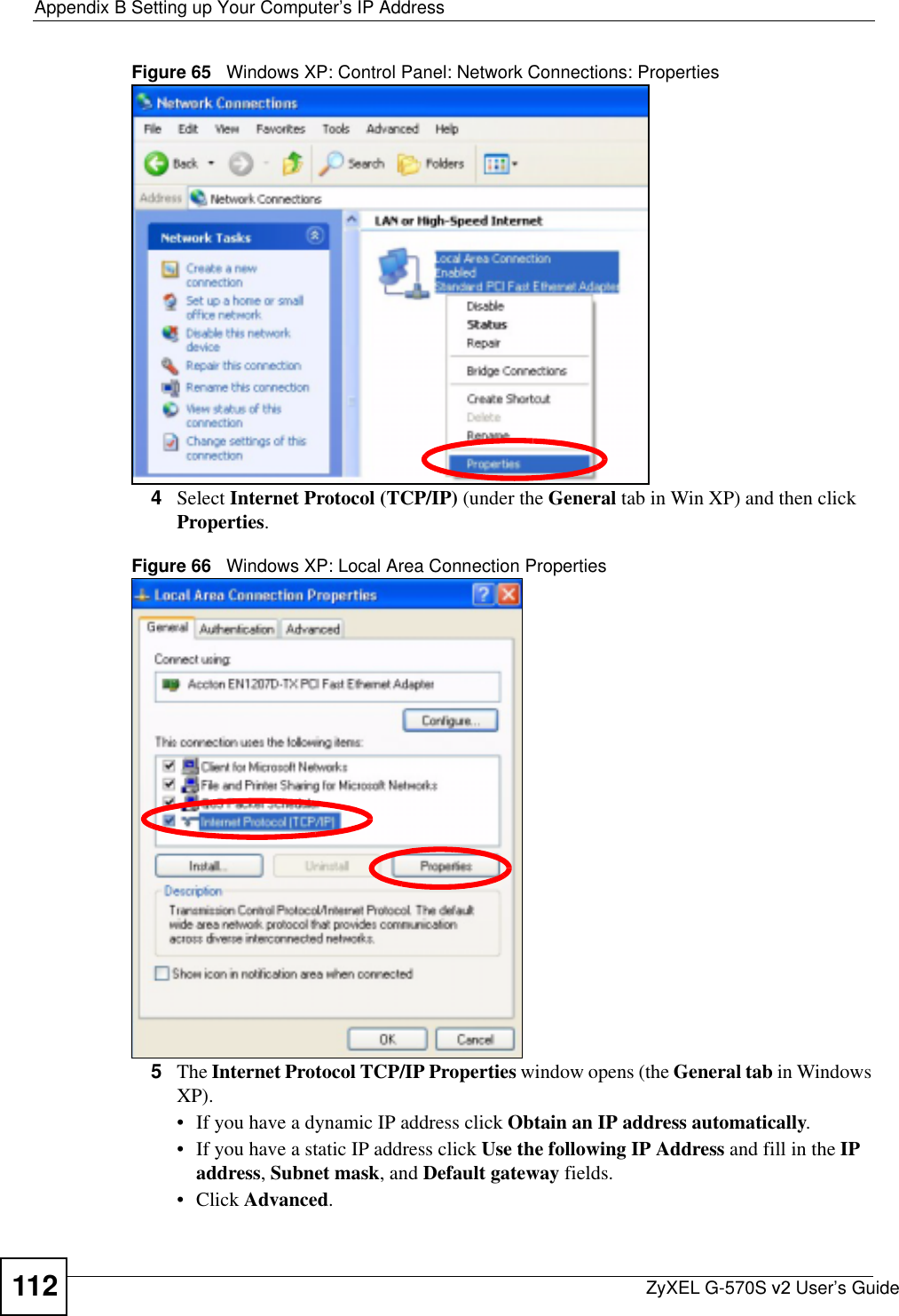 Appendix B Setting up Your Computer’s IP AddressZyXEL G-570S v2 User’s Guide112Figure 65   Windows XP: Control Panel: Network Connections: Properties4Select Internet Protocol (TCP/IP) (under the General tab in Win XP) and then click Properties.Figure 66   Windows XP: Local Area Connection Properties5The Internet Protocol TCP/IP Properties window opens (the General tab in Windows XP).• If you have a dynamic IP address click Obtain an IP address automatically.• If you have a static IP address click Use the following IP Address and fill in the IPaddress,Subnet mask, and Default gateway fields. • Click Advanced.