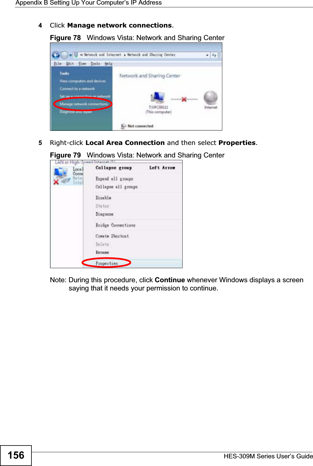 Appendix B Setting Up Your Computer’s IP AddressHES-309M Series User’s Guide1564Click Manage network connections.Figure 78   Windows Vista: Network and Sharing Center5Right-click Local Area Connection and then select Properties.Figure 79   Windows Vista: Network and Sharing CenterNote: During this procedure, click Continue whenever Windows displays a screen saying that it needs your permission to continue.