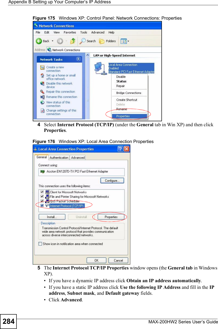 Appendix BSetting up Your Computer s IP AddressMAX-200HW2 Series User s Guide284Figure 175   Windows XP: Control Panel: Network Connections: Properties4Select Internet Protocol (TCP/IP) (under the General tab in Win XP) and then click Properties.Figure 176   Windows XP: Local Area Connection Properties5The Internet Protocol TCP/IP Properties window opens (the General tab in Windows XP). If you have a dynamic IP address click Obtain an IP address automatically. If you have a static IP address click Use the following IP Address and fill in the IPaddress,Subnet mask, and Default gateway fields.  Click Advanced.