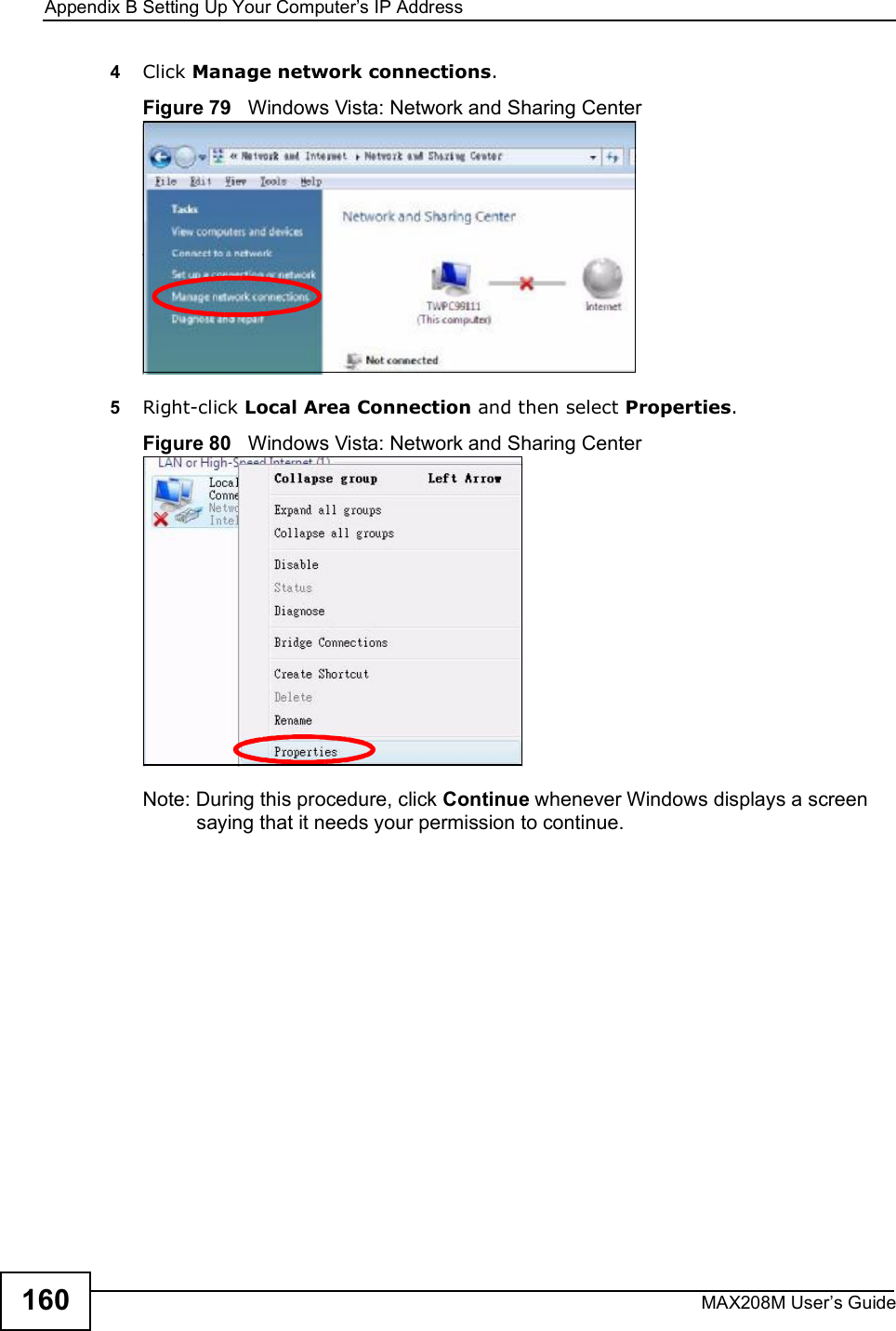 Appendix BSetting Up Your Computer s IP AddressMAX208M User s Guide1604Click Manage network connections.Figure 79   Windows Vista: Network and Sharing Center5Right-click Local Area Connection and then select Properties.Figure 80   Windows Vista: Network and Sharing CenterNote: During this procedure, click Continue whenever Windows displays a screen saying that it needs your permission to continue.