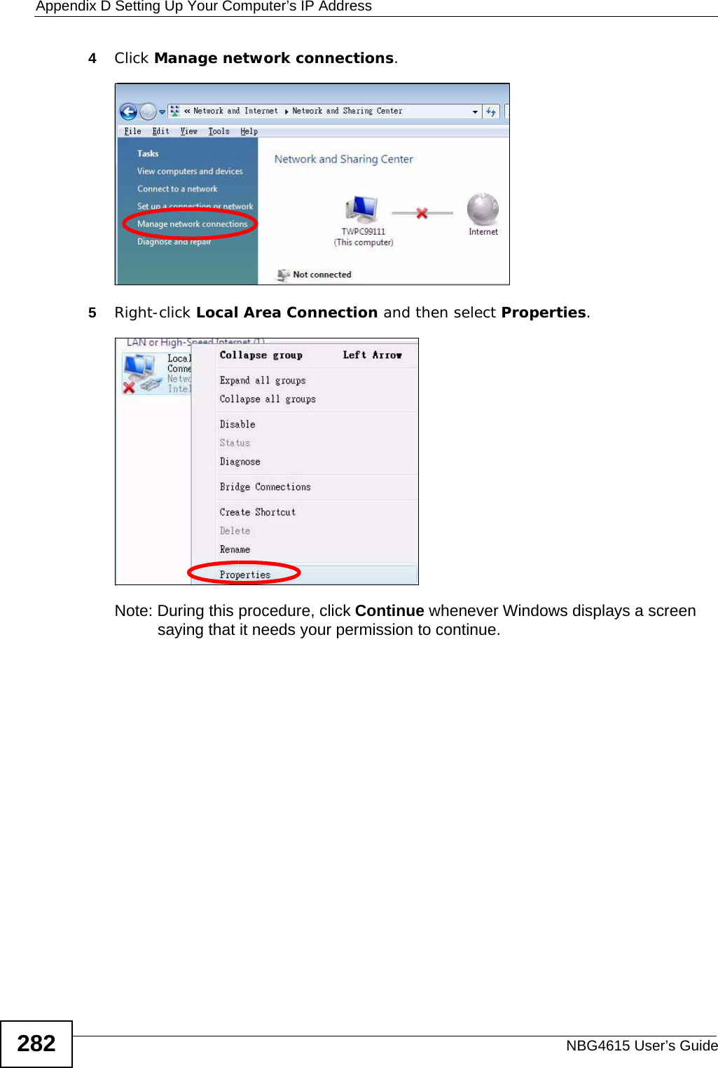 Appendix D Setting Up Your Computer’s IP AddressNBG4615 User’s Guide2824Click Manage network connections.5Right-click Local Area Connection and then select Properties.Note: During this procedure, click Continue whenever Windows displays a screen saying that it needs your permission to continue.
