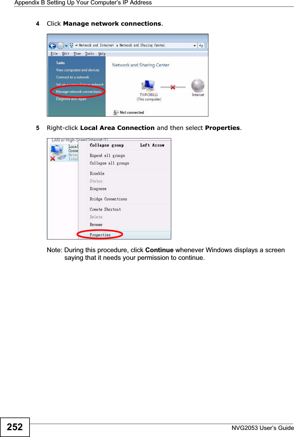 Appendix B Setting Up Your Computer’s IP AddressNVG2053 User’s Guide2524Click Manage network connections.5Right-click Local Area Connection and then select Properties.Note: During this procedure, click Continue whenever Windows displays a screen saying that it needs your permission to continue.