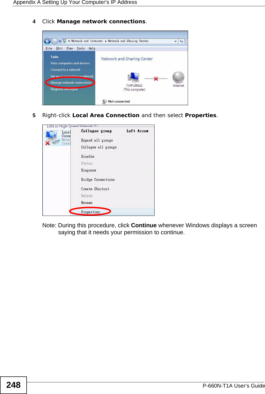 Appendix A Setting Up Your Computer’s IP AddressP-660N-T1A User’s Guide2484Click Manage network connections.5Right-click Local Area Connection and then select Properties.Note: During this procedure, click Continue whenever Windows displays a screen saying that it needs your permission to continue.