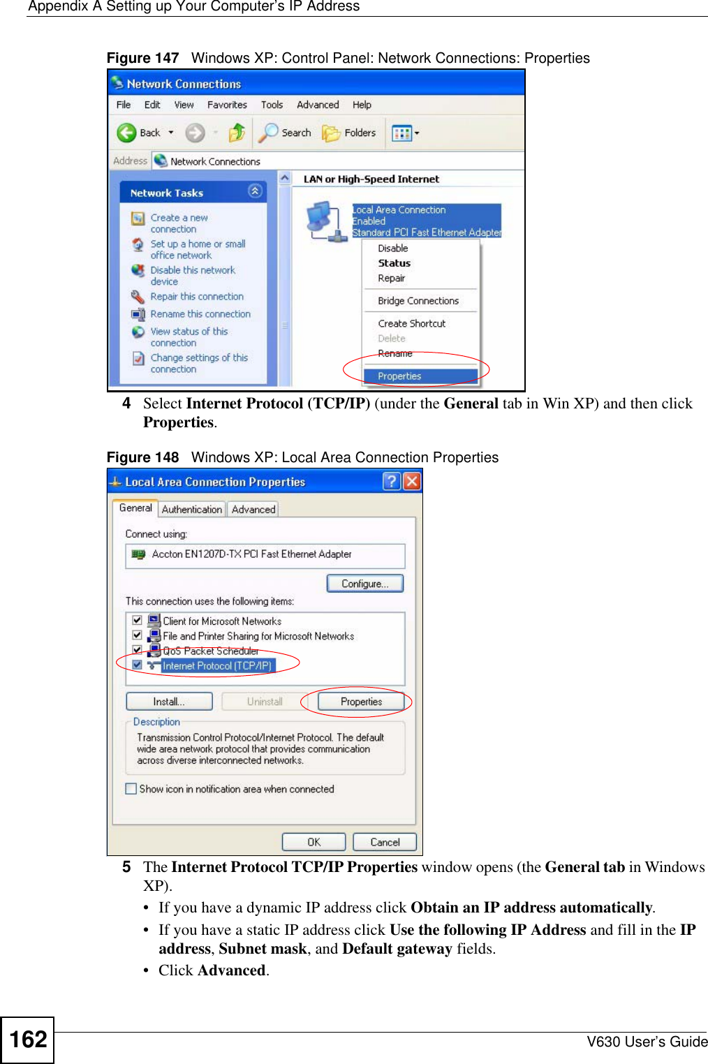 Appendix A Setting up Your Computer’s IP AddressV630 User’s Guide162Figure 147   Windows XP: Control Panel: Network Connections: Properties4Select Internet Protocol (TCP/IP) (under the General tab in Win XP) and then click Properties.Figure 148   Windows XP: Local Area Connection Properties5The Internet Protocol TCP/IP Properties window opens (the General tab in Windows XP).• If you have a dynamic IP address click Obtain an IP address automatically.• If you have a static IP address click Use the following IP Address and fill in the IP address, Subnet mask, and Default gateway fields. • Click Advanced.