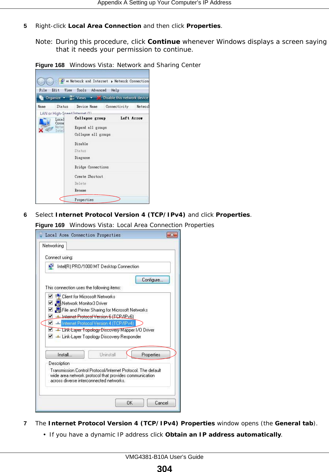 Appendix A Setting up Your Computer’s IP AddressVMG4381-B10A User’s Guide3045Right-click Local Area Connection and then click Properties.Note: During this procedure, click Continue whenever Windows displays a screen saying that it needs your permission to continue.Figure 168   Windows Vista: Network and Sharing Center6Select Internet Protocol Version 4 (TCP/IPv4) and click Properties.Figure 169   Windows Vista: Local Area Connection Properties7The Internet Protocol Version 4 (TCP/IPv4) Properties window opens (the General tab).• If you have a dynamic IP address click Obtain an IP address automatically.
