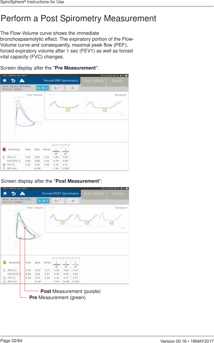 SpiroSphere® Instructions for UsePage 32/84  9HUVLRQ0$&lt;Screen display after the &quot;Pre Measurement&quot;:Perform a Post Spirometry MeasurementThe Flow-Volume curve shows the immediate bronchospasmolytic effect. The expiratory portion of the Flow-9ROXPHFXUYHDQGFRQVHTXHQWO\PD[LPDOSHDNÀRZ3()forced expiratory volume after 1 sec (FEV1) as well as forced vital capacity (FVC) changes.Screen display after the &quot;Post Measurement&quot;:Pre Measurement (green)Post Measurement (purple)