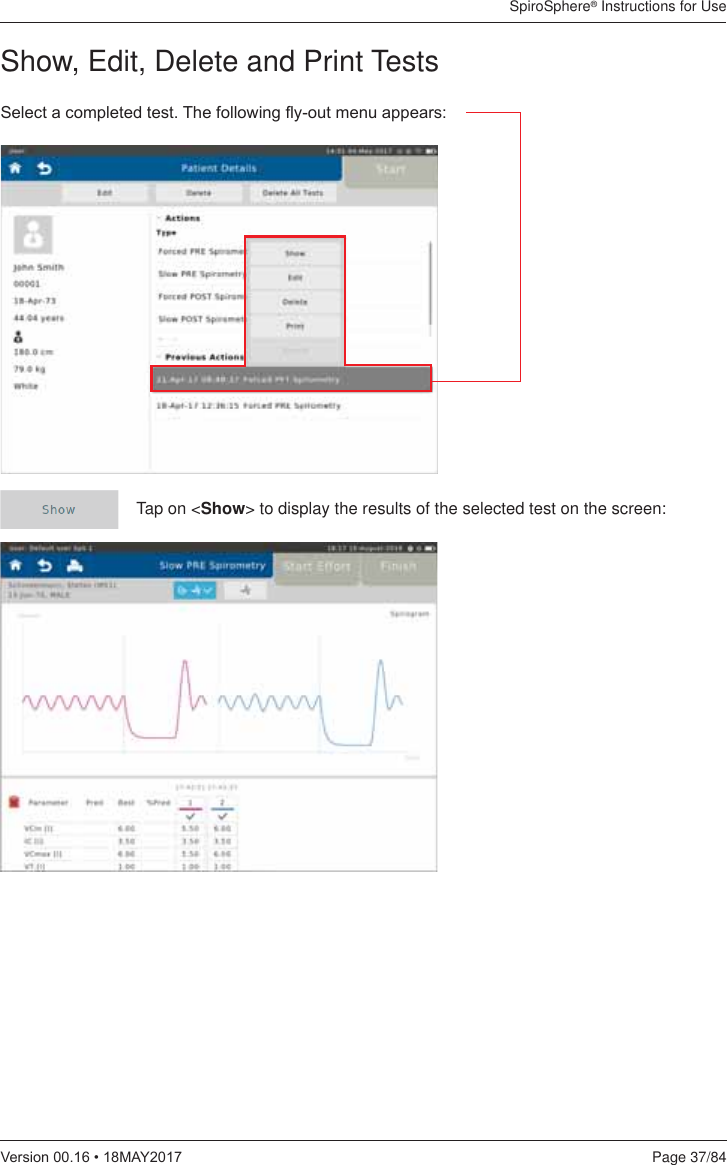 SpiroSphere® Instructions for UsePage 37/849HUVLRQ0$&lt;6HOHFWDFRPSOHWHGWHVW7KHIROORZLQJÀ\RXWPHQXDSSHDUVTap on &lt;Show&gt; to display the results of the selected test on the screen:Show, Edit, Delete and Print Tests