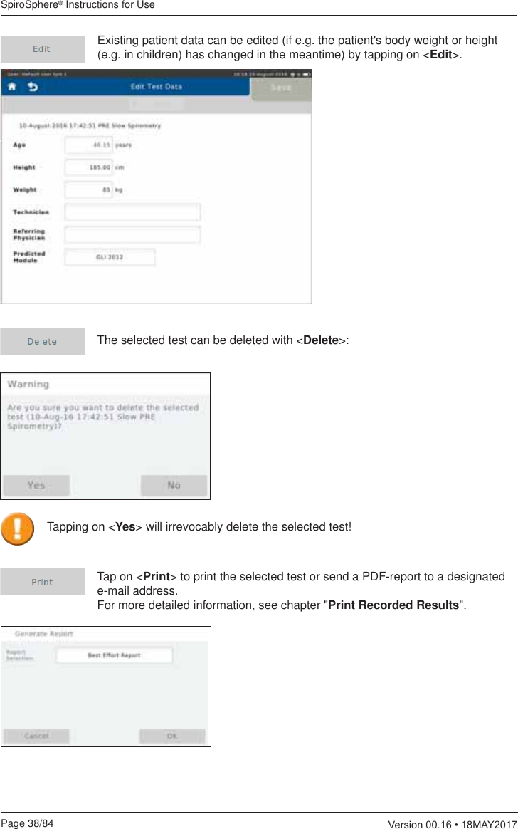 SpiroSphere® Instructions for UsePage 38/84  9HUVLRQ0$&lt;Existing patient data can be edited (if e.g. the patient&apos;s body weight or height (e.g. in children) has changed in the meantime) by tapping on &lt;Edit&gt;.The selected test can be deleted with &lt;Delete&gt;:Tap on &lt;Print&gt; to print the selected test or send a PDF-report to a designated e-mail address.  For more detailed information, see chapter &quot;Print Recorded Results&quot;.  Tapping on &lt;Yes&gt; will irrevocably delete the selected test!