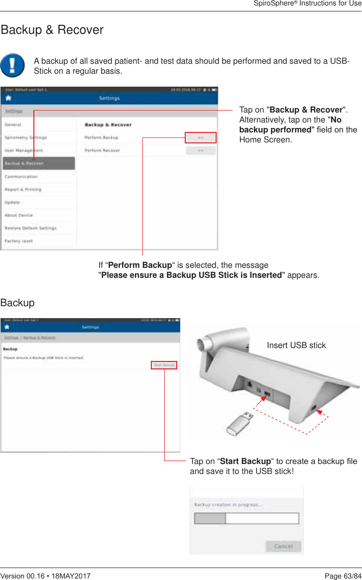 SpiroSphere® Instructions for UsePage 63/849HUVLRQ0$&lt;Backup &amp; RecoverBackupTap on &quot;Backup &amp; Recover&quot;. Alternatively, tap on the &quot;No backup performed¿HOGRQWKHHome Screen.If “Perform Backup“ is selected, the message  &quot;Please ensure a Backup USB Stick is Inserted&quot; appears.Tap on “Start Backup³WRFUHDWHDEDFNXS¿OHand save it to the USB stick!Insert USB stickA backup of all saved patient- and test data should be performed and saved to a USB-Stick on a regular basis.