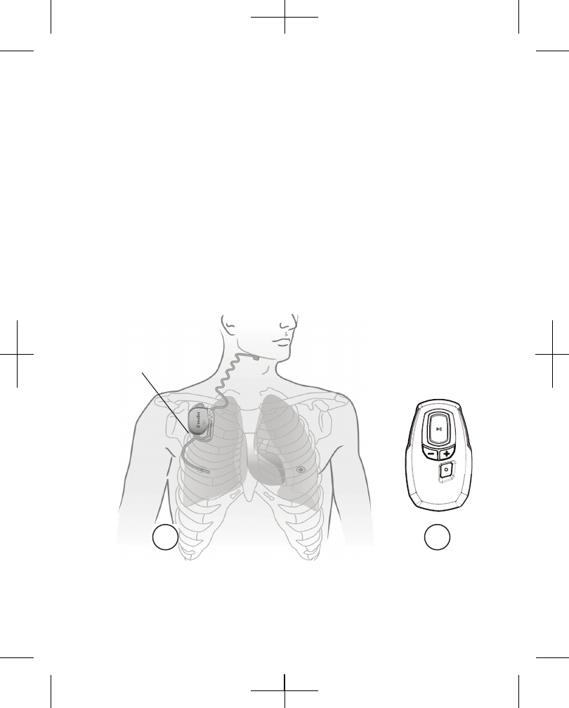 Inspire Medical Systems 2500 Patient Programmer for IPG User Manual 3032EN